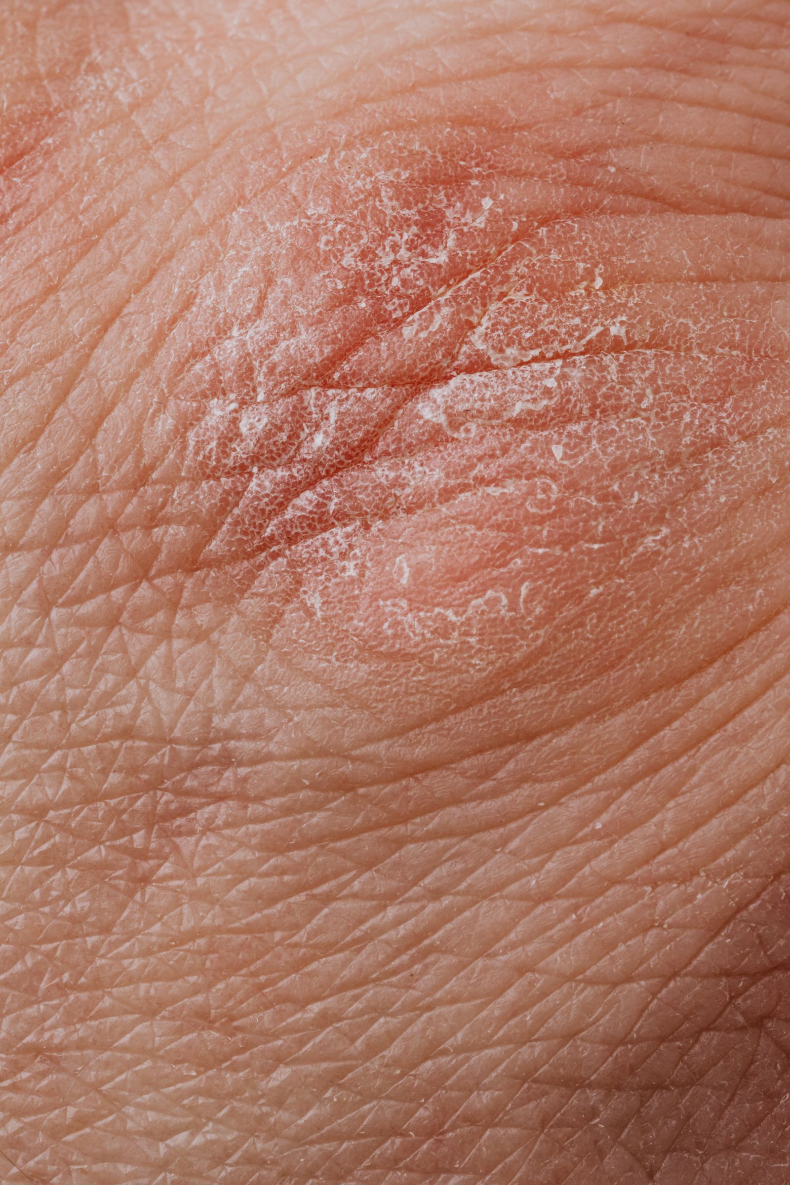 Skin Lumps and Bumps in Senior Pets: What's Usually Fine and What Isn't illustration